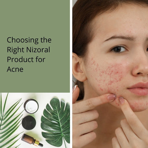 Choosing the Right Nizoral Product for Acne