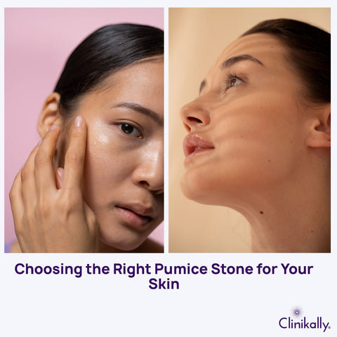 Choosing the Right Pumice Stone for Your Skin