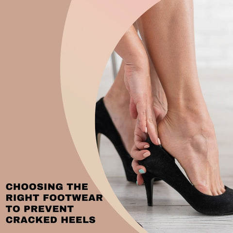 Choosing the right footwear to prevent cracked heels