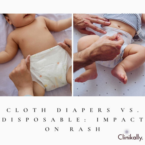 Cloth diapers vs. disposable: Impact on rash