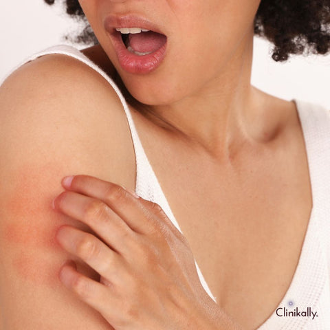 Clothing materials and skin irritation