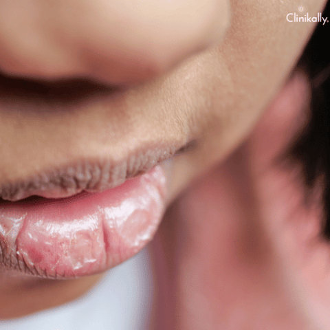 coconut oil for lips