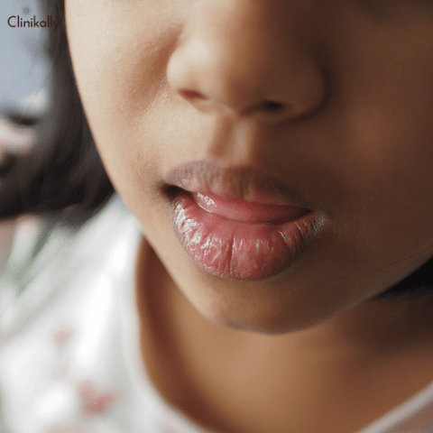 coconut oil for lips