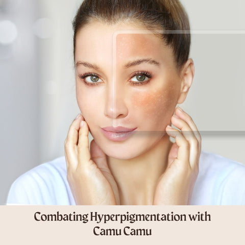 Combating Hyperpigmentation with Camu Camu
