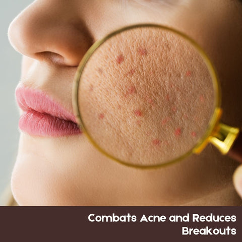 Combats Acne and Reduces Breakouts