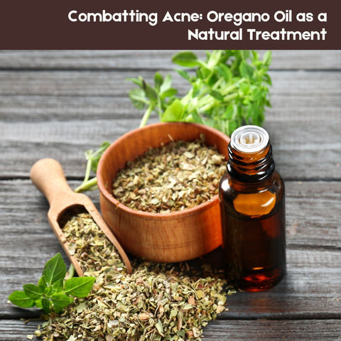 Combatting Acne: Oregano Oil as a Natural Treatment