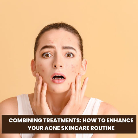 Combining Treatments: How to Enhance Your Acne Skincare Routine