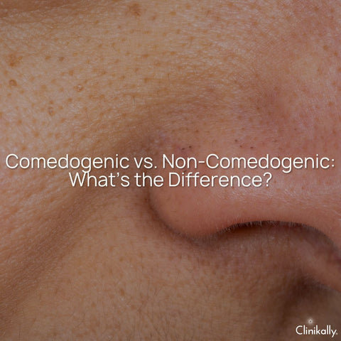 Comedogenic vs. Non-Comedogenic: What’s the Difference?