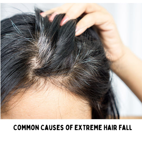 Common Causes of Extreme Hair Fall