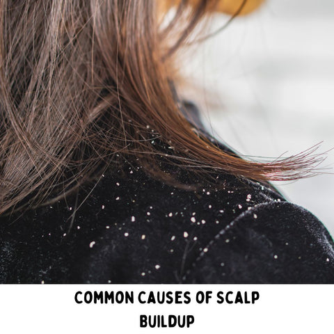 Common Causes of Scalp Buildup