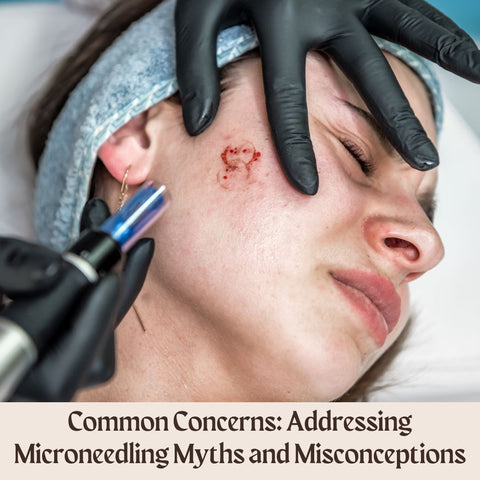 Common Concerns: Addressing Microneedling Myths and Misconceptions