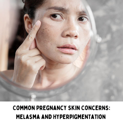 Common Pregnancy Skin Concerns: Melasma and Hyperpigmentation