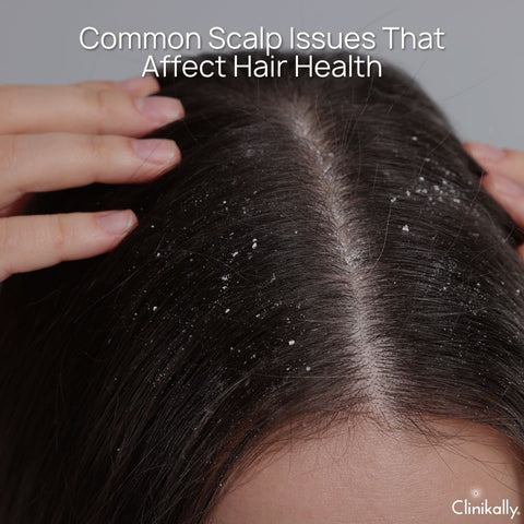 Common Scalp Issues That Affect Hair Health