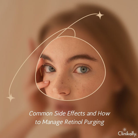 Common Side Effects and How to Manage Retinol Purging