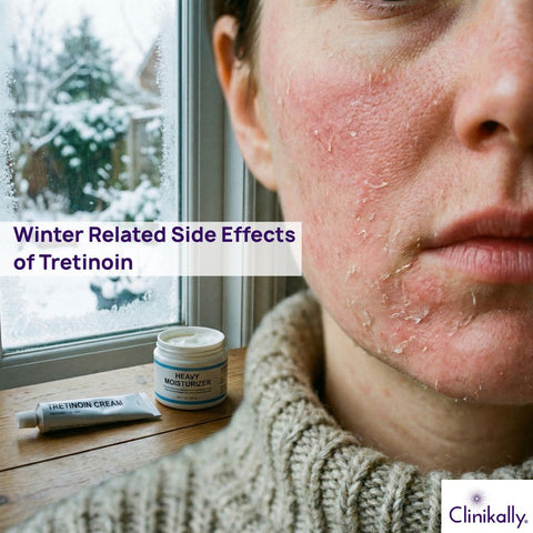 Common Side Effects of Tretinoin in Winter