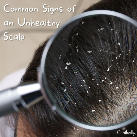 Common Signs of an Unhealthy Scalp
