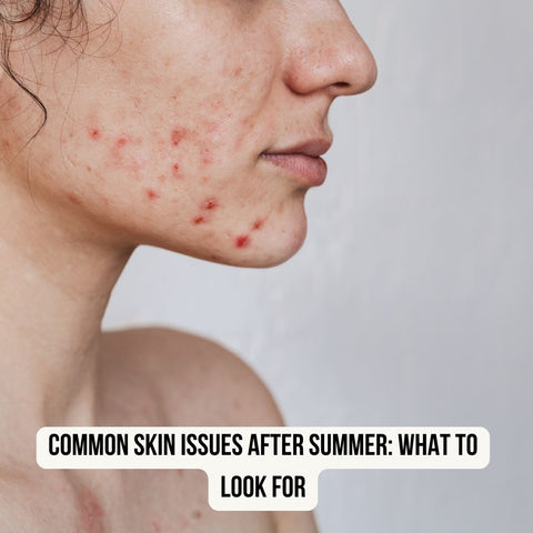 Common Skin Issues After Summer: What to Look For