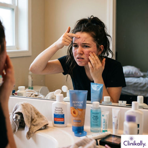 Teen with acne examining breakouts in the mirror