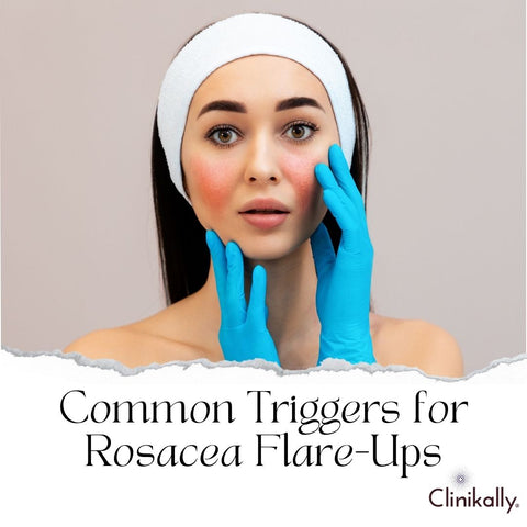 Common Triggers for Rosacea Flare-Ups