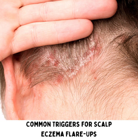 Common Triggers for Scalp Eczema Flare-Ups