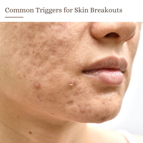 Common Triggers for Skin Breakouts