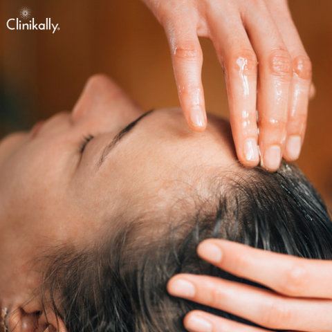 Exploring the Link Between Saw Palmetto and Hair Loss Myth or Reality