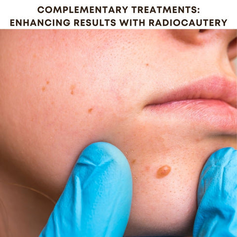 Complementary Treatments: Enhancing Results with Radiocautery