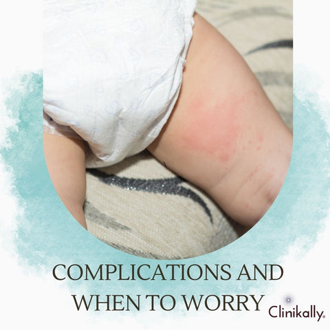 Complications and when to worry