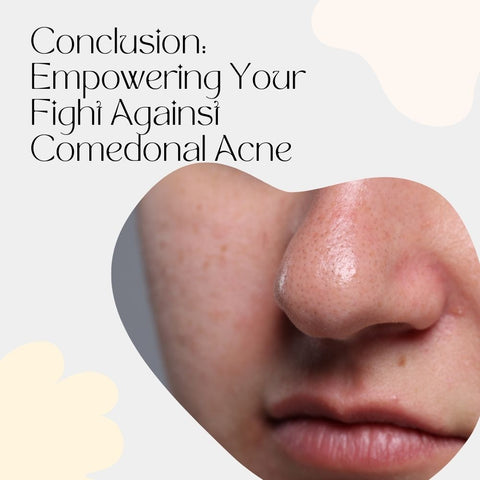 Conclusion: Empowering Your Fight Against Comedonal Acne