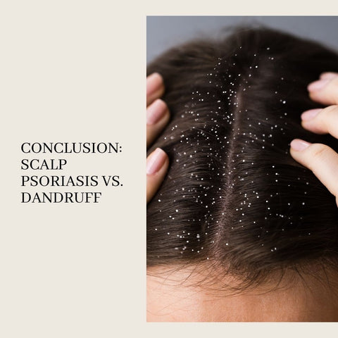 Conclusion: Scalp Psoriasis vs. Dandruff