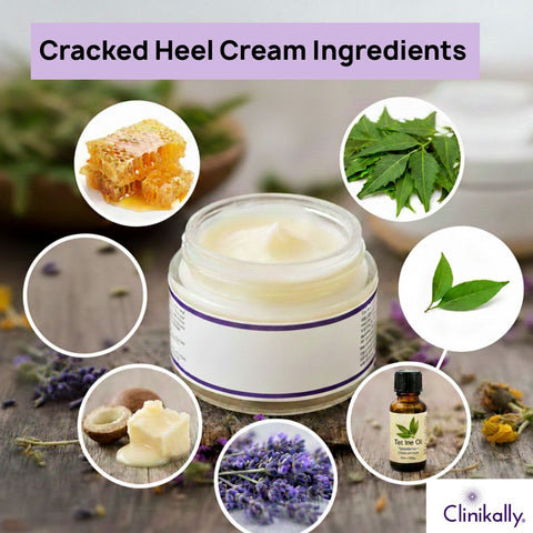 Key Ingredients to Look for in Cracked Heel Cream