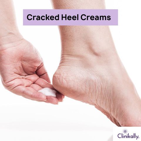 Effective Cracked Heel Creams