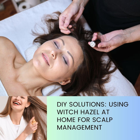 DIY Solutions: Using Witch Hazel at Home for Scalp Management