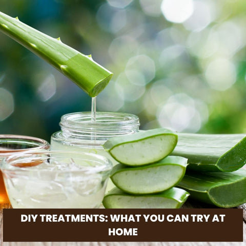 DIY Treatments: What You Can Try at Home