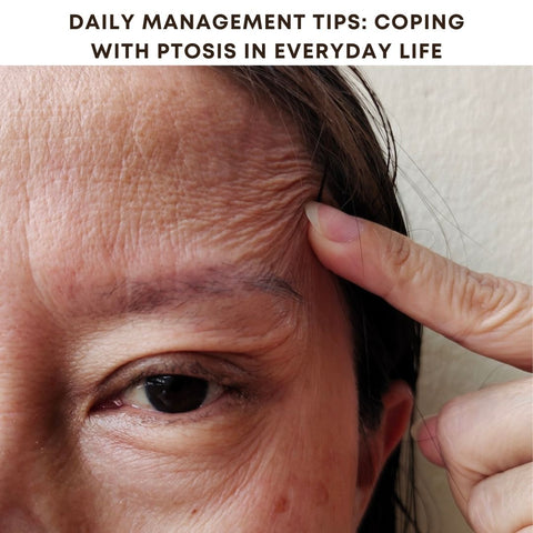 Daily Management Tips: Coping with Ptosis in Everyday Life