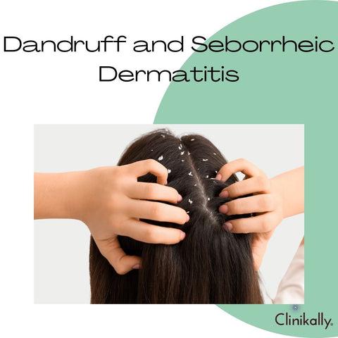 Dandruff and Seborrheic Dermatitis