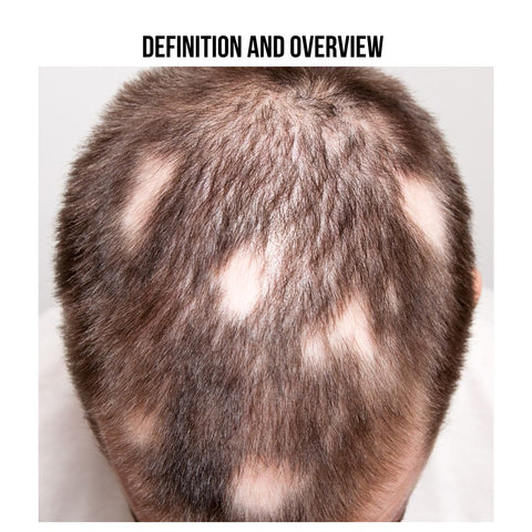 Definition and Overview
