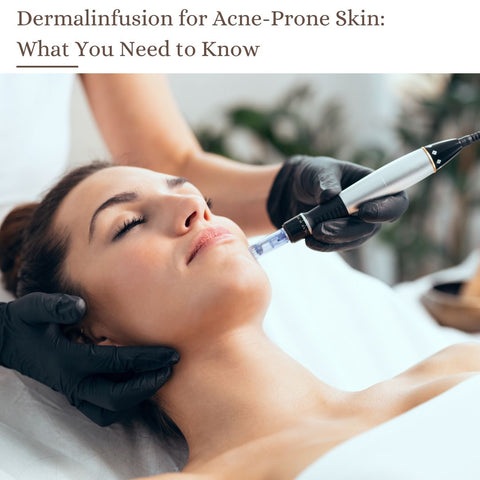 Dermalinfusion for Acne-Prone Skin: What You Need to Know