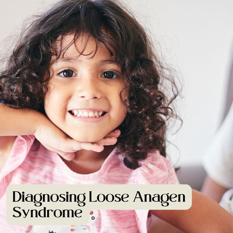 Diagnosing Loose Anagen Syndrome