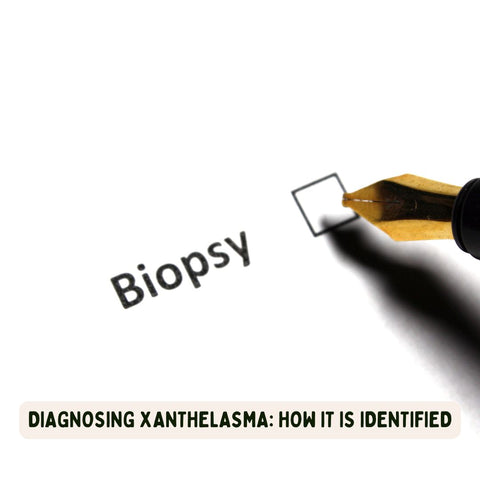 Diagnosing Xanthelasma: How It Is Identified