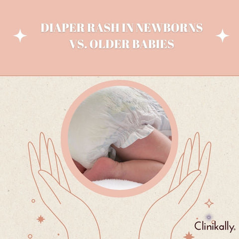 Diaper rash in newborns vs. older babies