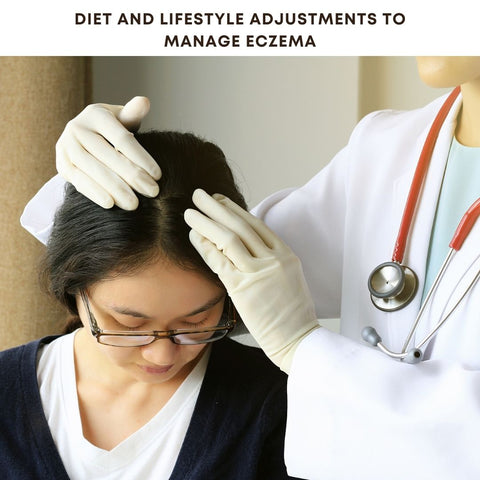 Diet and Lifestyle Adjustments to Manage Eczema