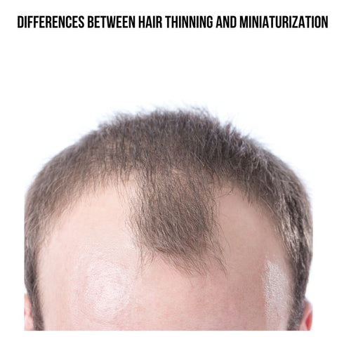 Differences Between Hair Thinning and Miniaturization