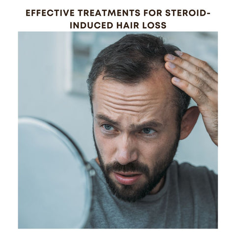 Effective Treatments for Steroid-Induced Hair Loss