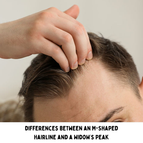 Differences Between an M-Shaped Hairline and a Widow’s Peak