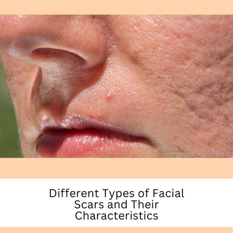 Different Types of Facial Scars and Their Characteristics
