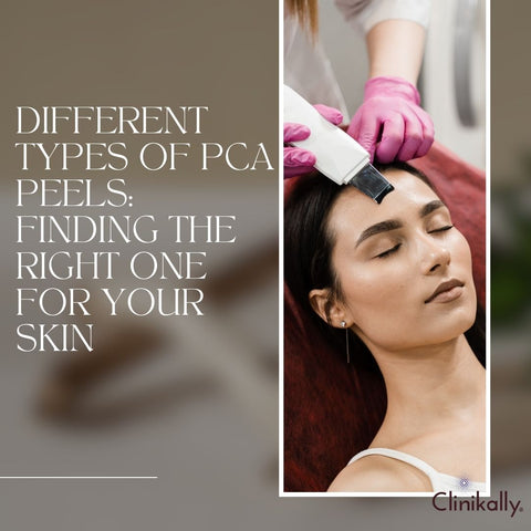 Different Types of PCA Peels: Finding the Right One for Your Skin