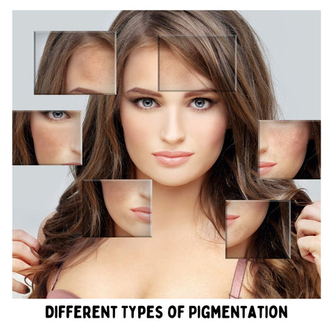 Different Types of Pigmentation