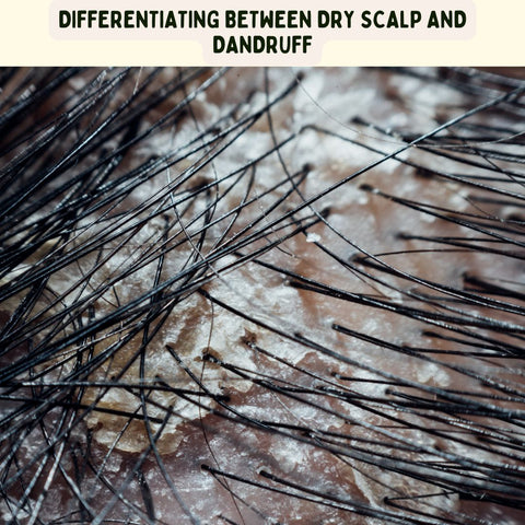 Differentiating Between Dry Scalp and Dandruff