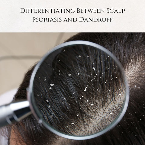 Differentiating Between Scalp Psoriasis and Dandruff